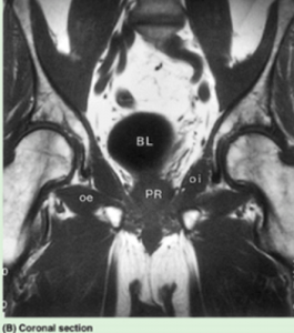 MRI Pelvic Muscles
