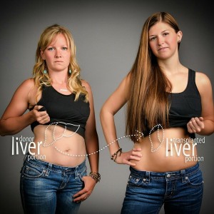 Jaimie Cuzick will give the gift of life to life-long friend, Kailyn McIrvin, by donating a portion of her liver. Photo credit: Cooper Studios.