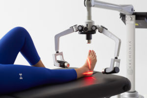 plantar fasciitis laser