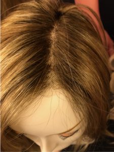 Radiant Hair & Skin scalp wig view