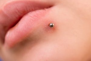 upclose photo of a recently pierce lip stud, slightly red