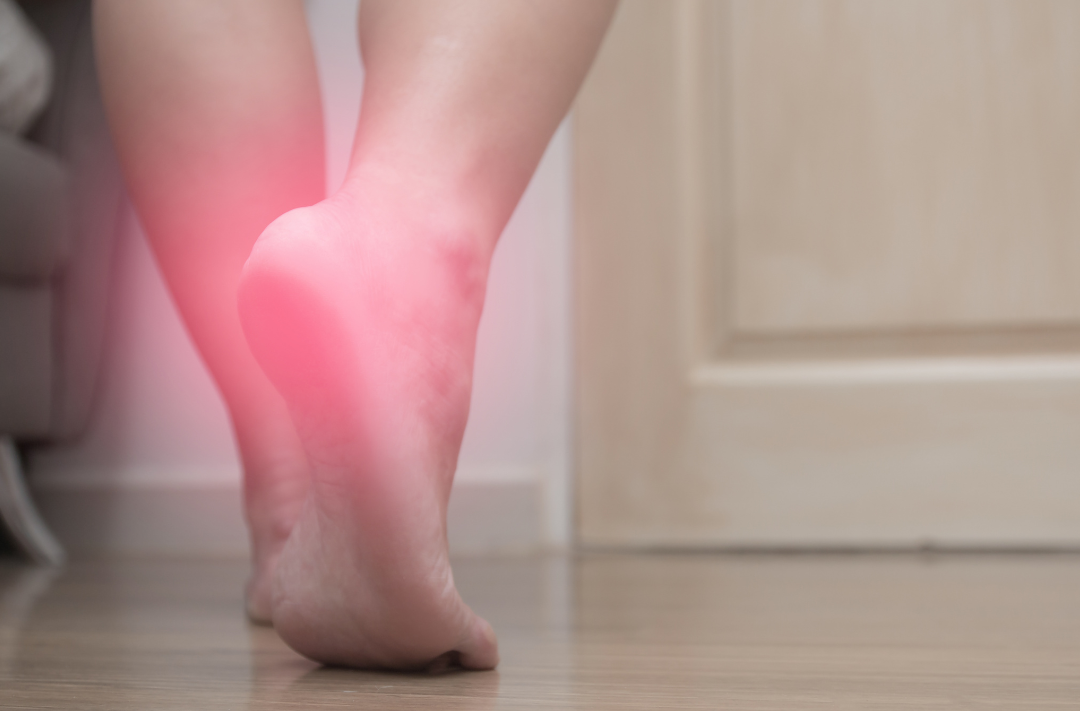 Penrose Physical Therapy in Lacey Answers: What Causes Plantar Fasciitis and What Can You Do About It?